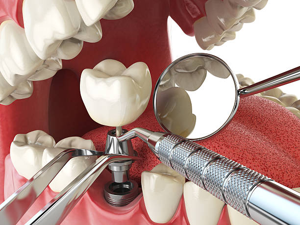 Best Weekend Emergency Dentist in Danville, IN